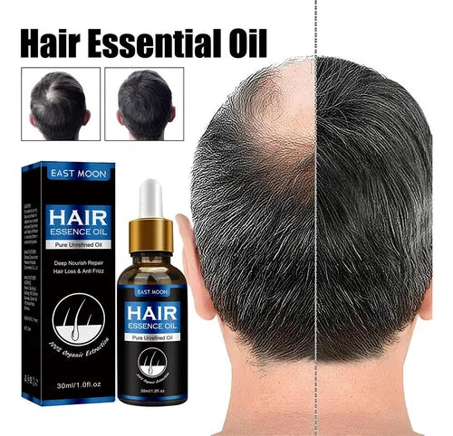 SelenoraBeauty™ East Moon Men’s Dense Hair Serum – Vitamin E Hair Growth Oil | Strengthening, Anti-Hair Loss, Scalp Repair & Moisturizing Treatment (30ml)