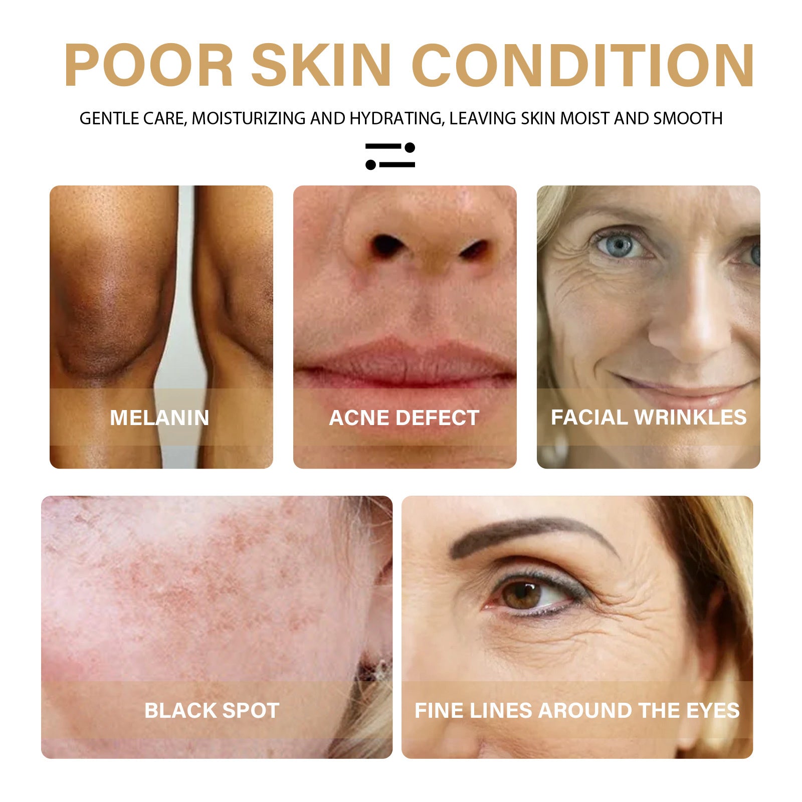 SelenoraBeauty™ Turmeric Dark Spot Correcting Serum – Brightening & Anti-Aging Face Serum | Fade Dark Spots, Acne Marks & Uneven Skin Tone with Natural Turmeric & Olive Oil (30ml)