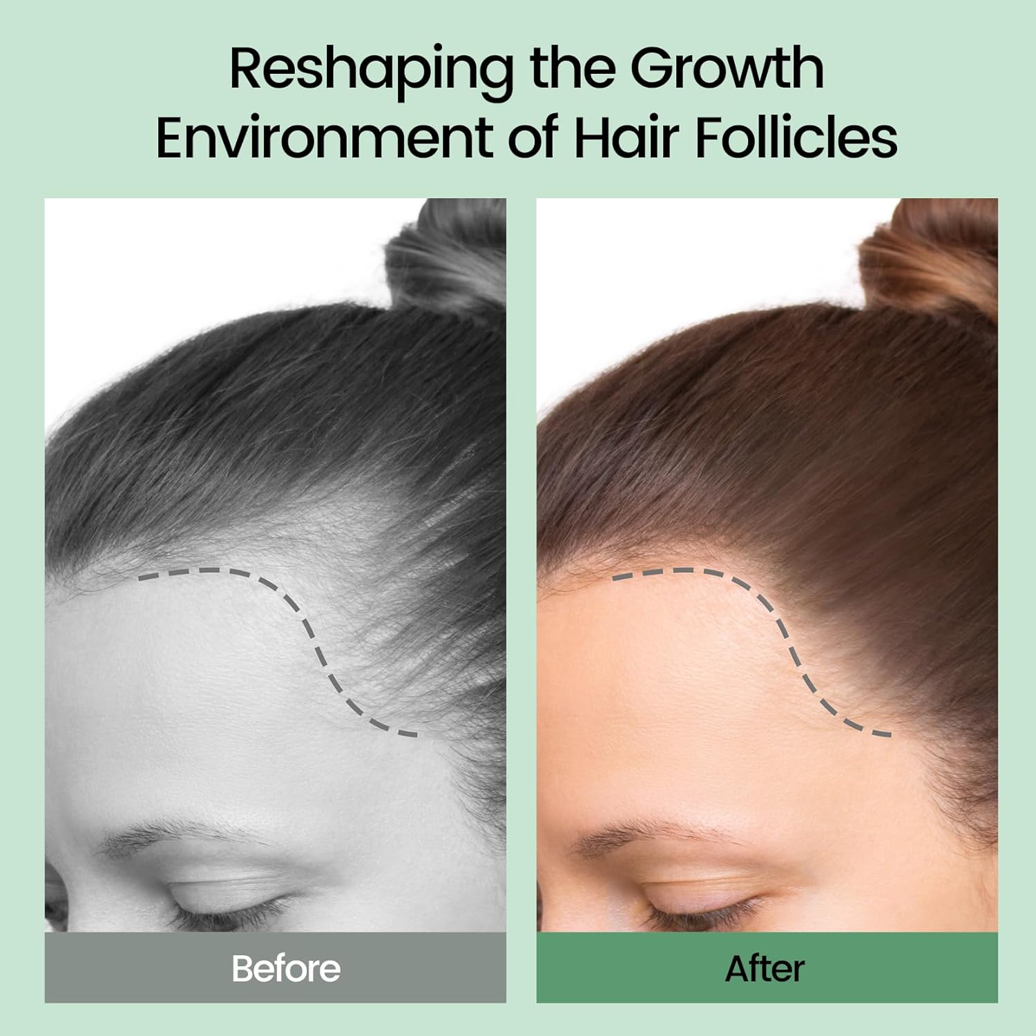 SelenoraBeauty™ Sysni Organic Rosemary & Tea Tree Keratin Shampoo – Strengthening, Nourishing & Hair Growth Formula (Anti-Dandruff & Damage Repair)