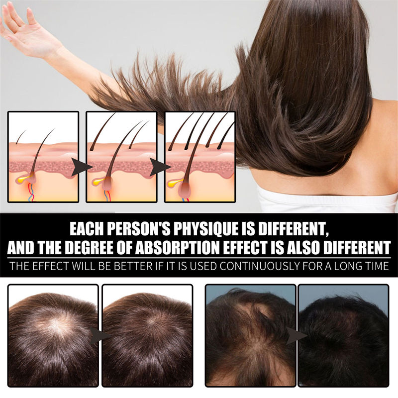 SelenoraBeauty™ Collagen B7 Hair Growth & Strengthening Serum | Liquid Biotin + Collagen Oil for Hair Regrowth, Thickness & Shine | Anti-Hair Loss & Scalp Nourishing Formula (30ml)