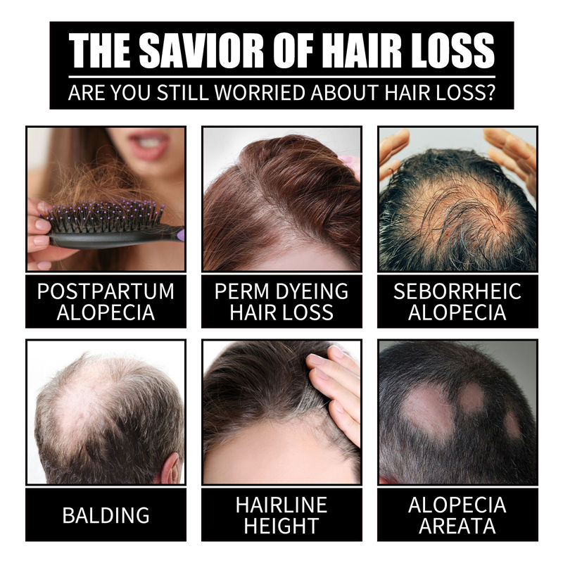 SelenoraBeauty™ Collagen B7 Hair Growth & Strengthening Serum | Liquid Biotin + Collagen Oil for Hair Regrowth, Thickness & Shine | Anti-Hair Loss & Scalp Nourishing Formula (30ml)