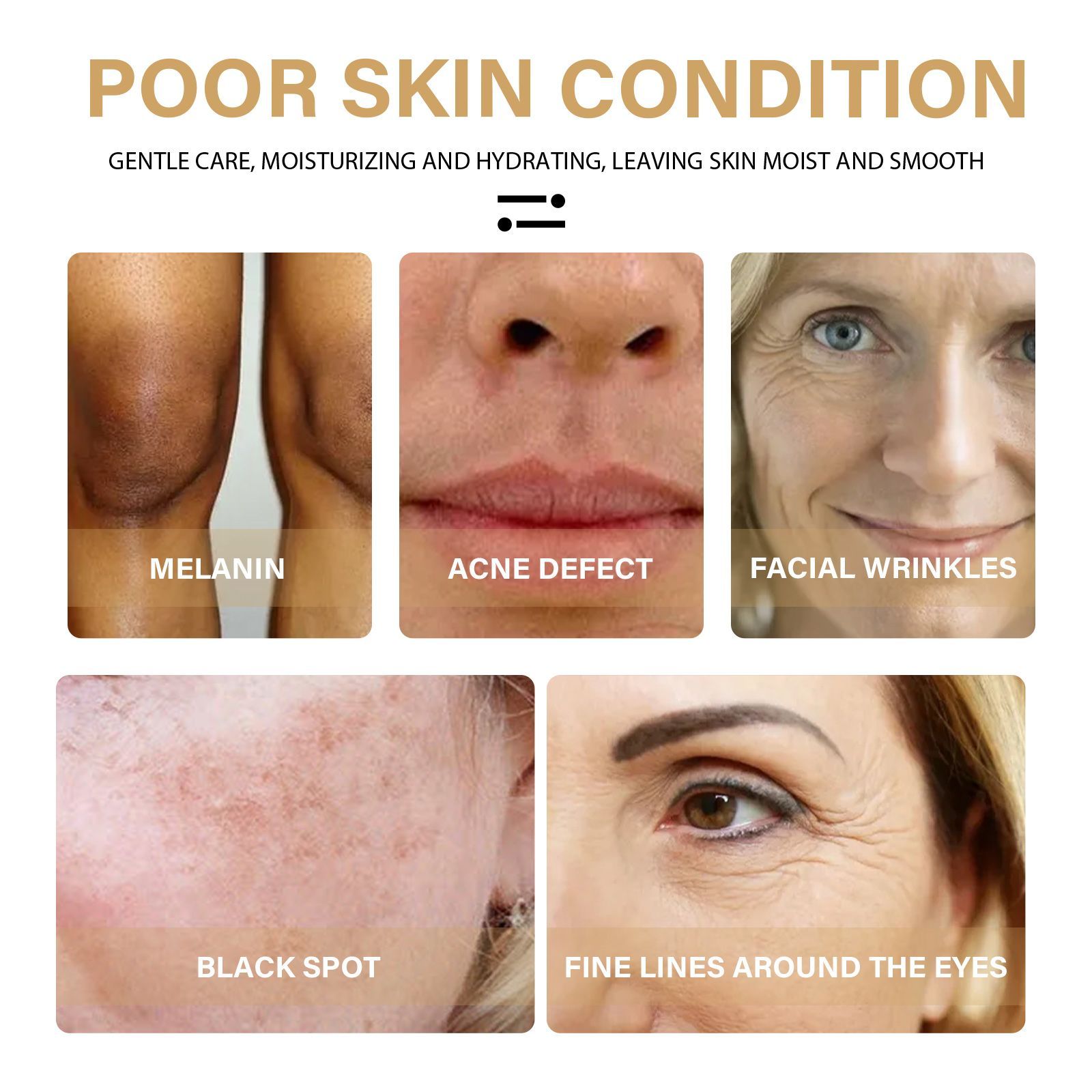 SelenoraBeauty™ Turmeric Dark Spot Correcting Serum – Brightening & Anti-Aging Face Serum | Fade Dark Spots, Acne Marks & Uneven Skin Tone with Natural Turmeric & Olive Oil (30ml)